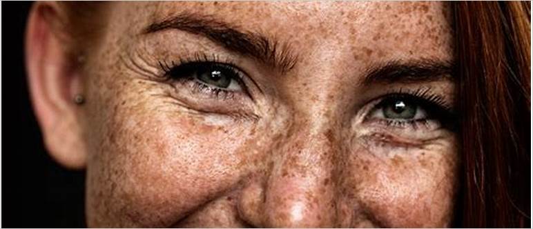 Beautiful freckled woman